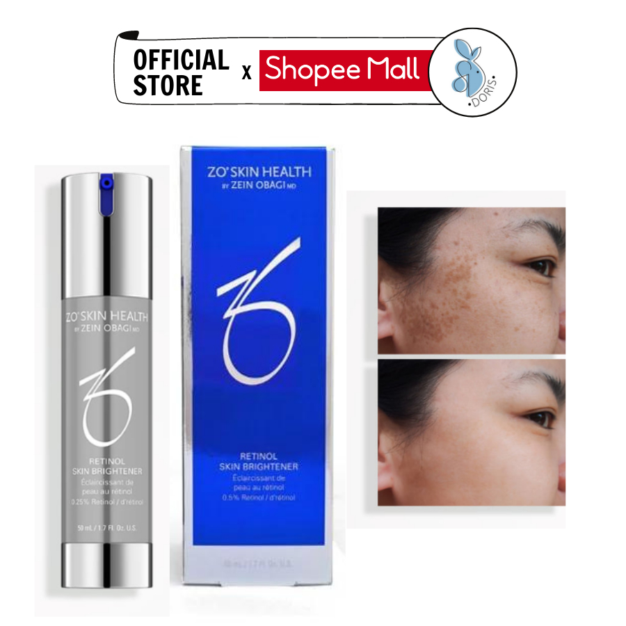 Kem dưỡng trắng da Zo RETINOL SKIN BRIGHTENER 0,5% giúp cải thiện màu da và phá vỡ các hắc tố