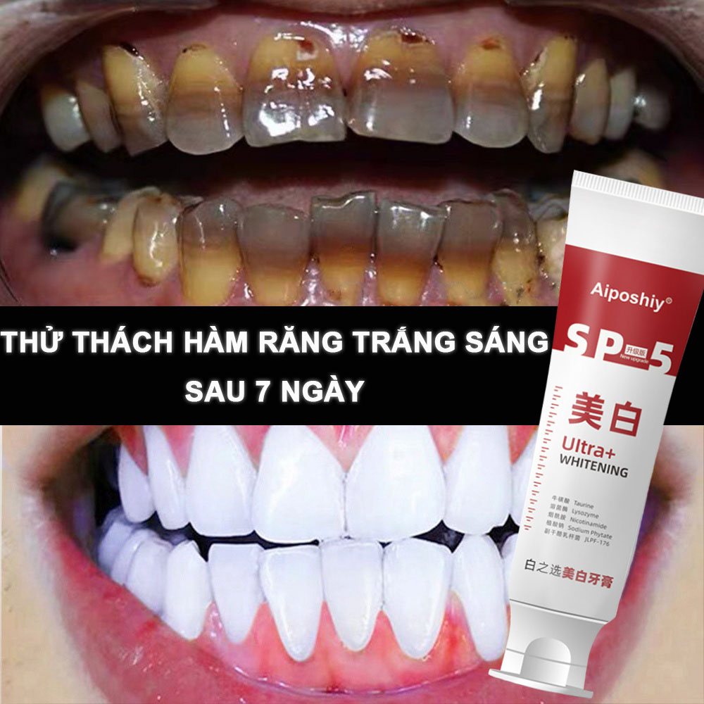 Kem Đánh Răng Làm Trắng Sáng Loại Bỏ Sạch Mảng Bám Ố Vàng Và Cao Răng Loại Bỏ Hôi Miệng Hơi Thở Khó Chịu