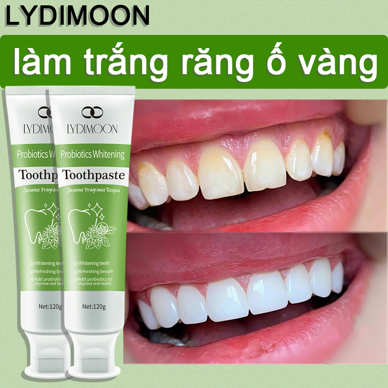 LYDIMOON💥Kem đánh răng làm trắng răng loại bỏ răng vàng hôi miệng Hiệu Quả tẩy trắng răng Kem đánh răng men 120gvi sinh