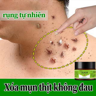 Loại bỏ nốt ruồi và mụn cóc kem tẩy nốt ruồi mụn cóc 20gTẩy mụn cóc nốt ruồi cấp tốc trong 7ngày Không đau và không sẹ