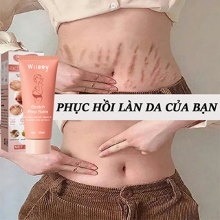 Kem rạn da Kem rạn da cho bà bầu Kem trị rạn da 50g Chống rạn da Chống nếp nhăn do giảm cân Sửa chữa tổn thương da