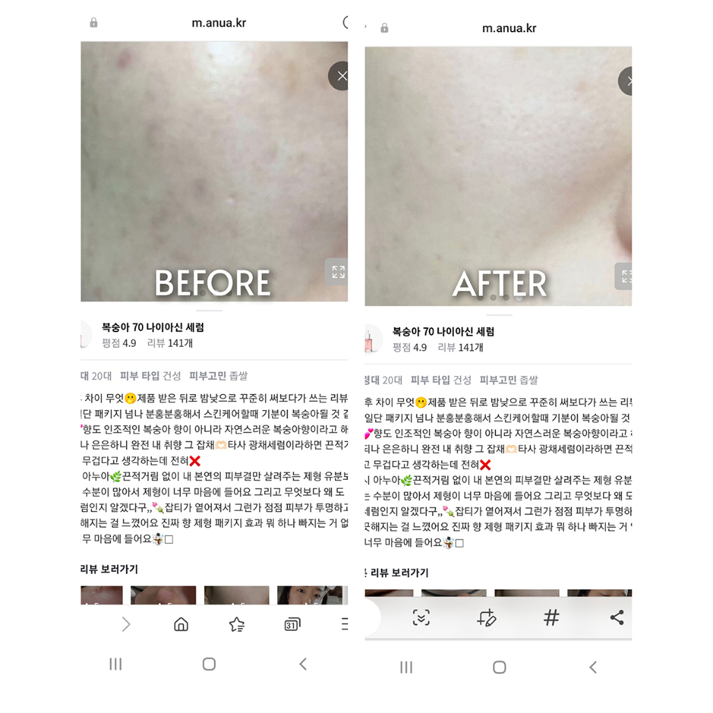 Serum dưỡng trắng Niacinamide 5% ANUA PEACH 70 NIACIN SERUM