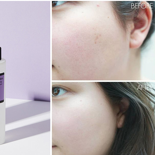 Toner Cosrx Giảm Mụn - Cosrx AHA BHA Clarifying Treatment Toner