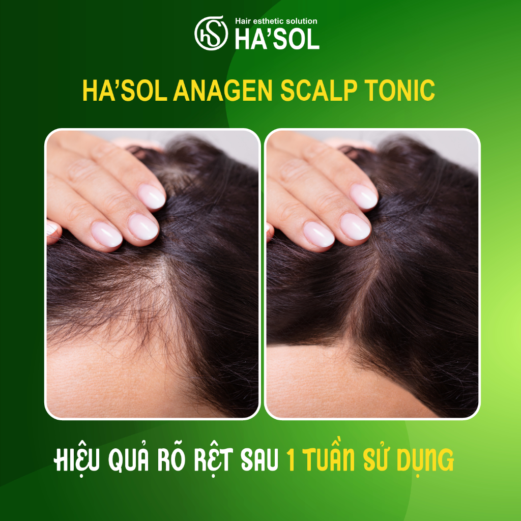 Combo Dầu Gội Chống Gàu Nấm Ngứa Clean Scalp Hasol 500g + Xịt Dưỡng Kích Mọc Tóc Hasol 100ml