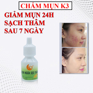[HOT] Kem chấm mụn siêu tốc mụn đầu đen, trứng cá, mụn bọc mờ thâm liền sẹo K3 (10g)