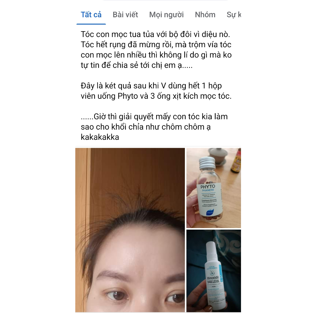 Viên PHYTO Phanere hỗ trợ mọc tóc, giảm rụng tóc dưỡng móng - hộp 120 viên, Senya Beauty