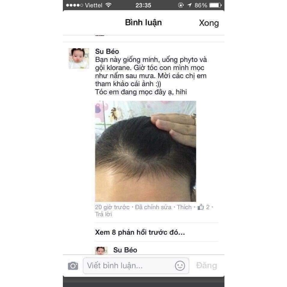 Viên PHYTO Phanere hỗ trợ mọc tóc, giảm rụng tóc dưỡng móng - hộp 120 viên, Senya Beauty