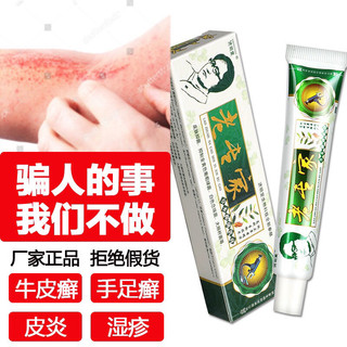 Kem bôi ngứa ngoài da