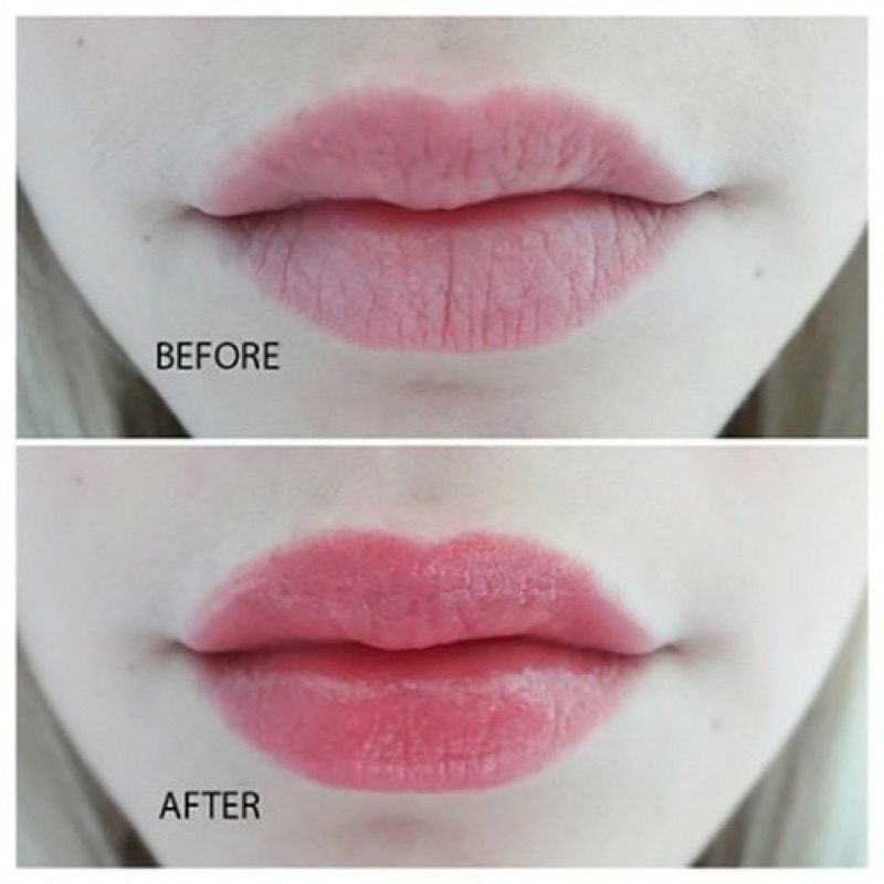 DƯỠNG MÔI VASELINE 7G