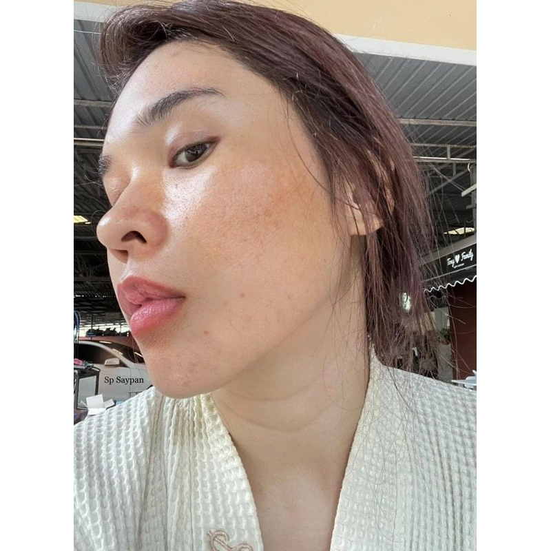 Rượu rễ cây mật gấu dạng vòi xịt chuyên mụn , thâm nám tàn nhang handmade