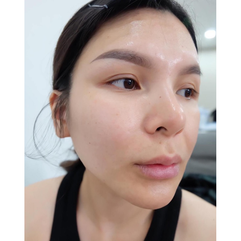 Rượu rễ cây mật gấu dạng vòi xịt chuyên mụn , thâm nám tàn nhang handmade