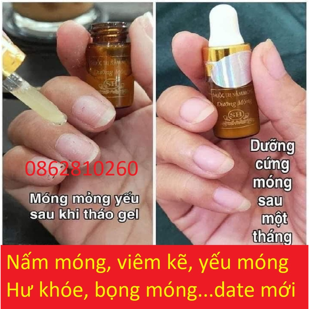 Serum Nấm Móng Tay Chân Sh, Hết Sạch nấm móng, Bọng Móng, Hư Khoé, Nước Ăn Tay Chân, Dưỡng Cứng Móng