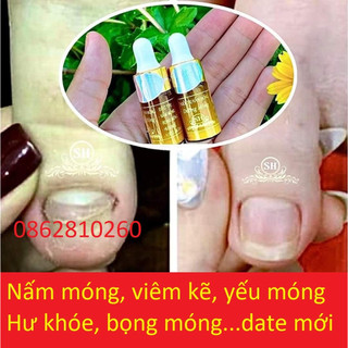 Serum nấm móng tay chân sh, hết sạch nấm móng, bọng móng, hư khoé, nước ăn tay chân, dưỡng cứng móng