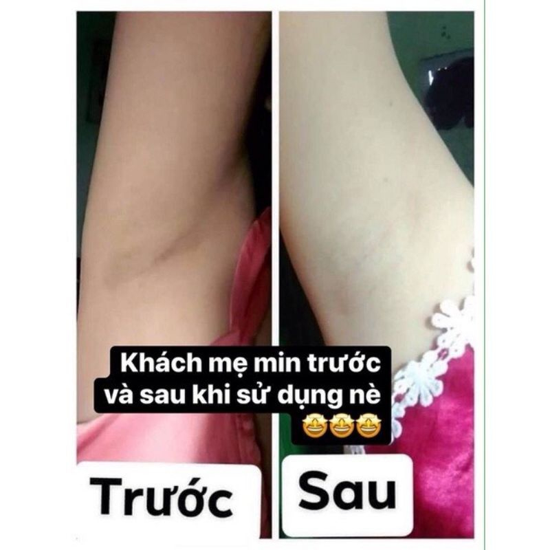 Mờ thâm Nách Cô Bơ  Giúp Khử Mùi Hôi Nách, Ngăn Mồ Hôi, Dưỡng Trắng Nách