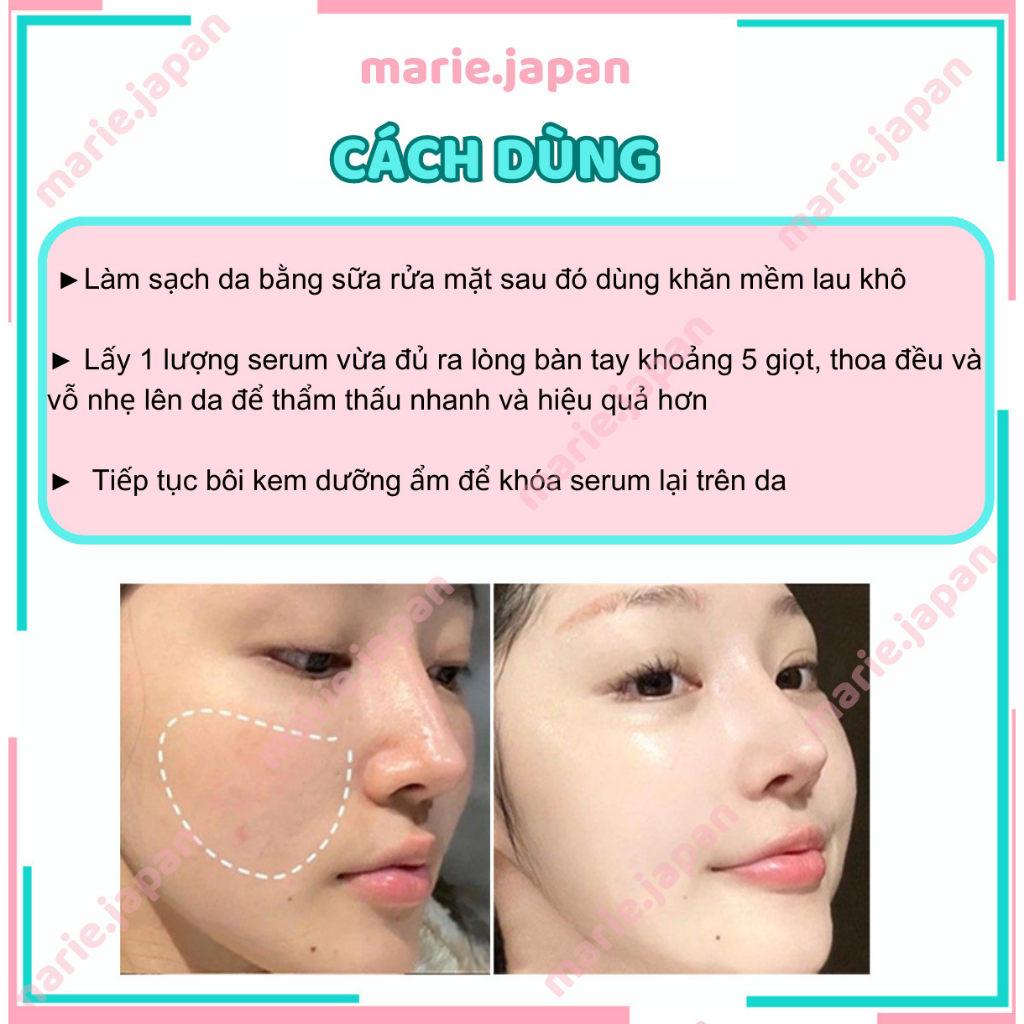 Tinh chất ngăn mụn mờ thâm Balance Niacinamide 15% Blemish Recovery 30ml