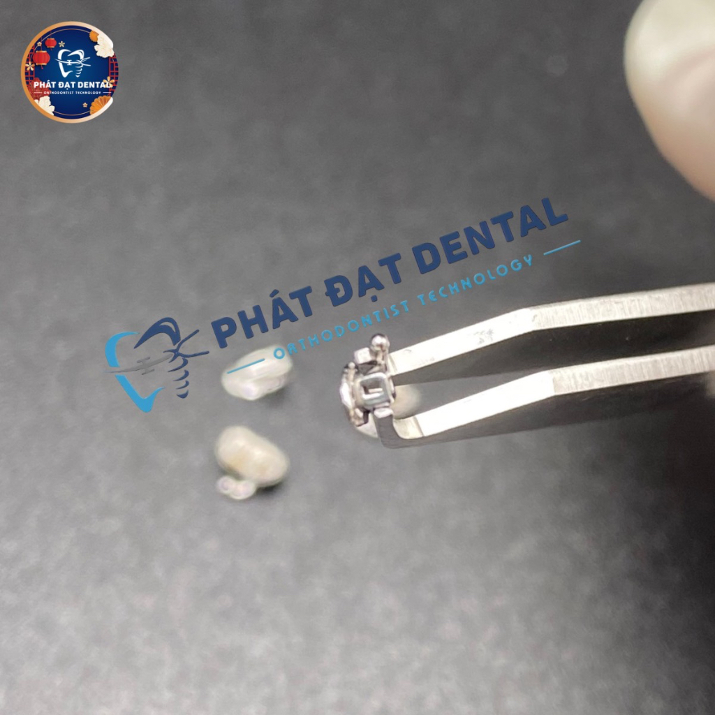 Mắc Cài Kim Loại Răng Số 7 Chỉnh Nha