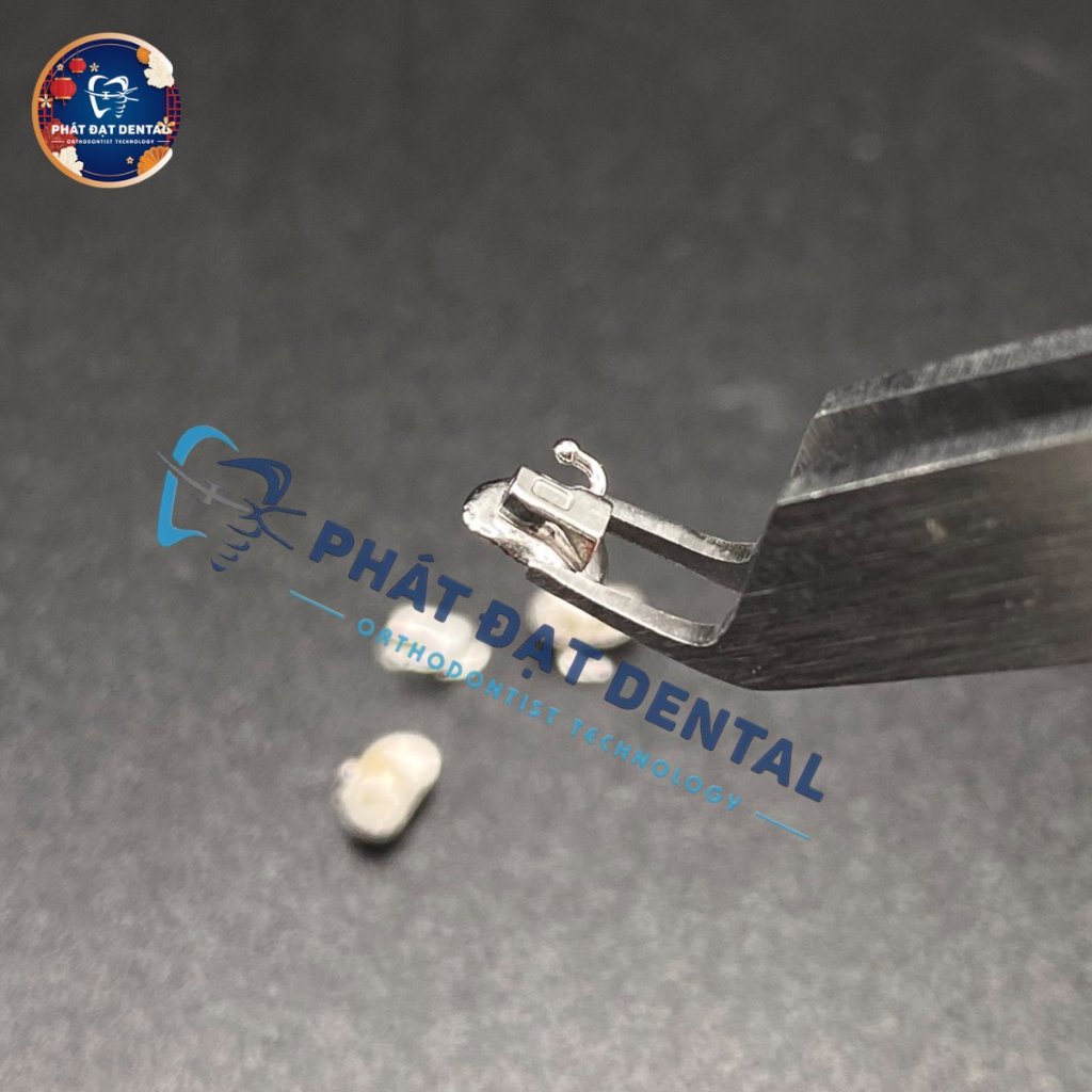 Mắc Cài Kim Loại Răng Số 7 Chỉnh Nha