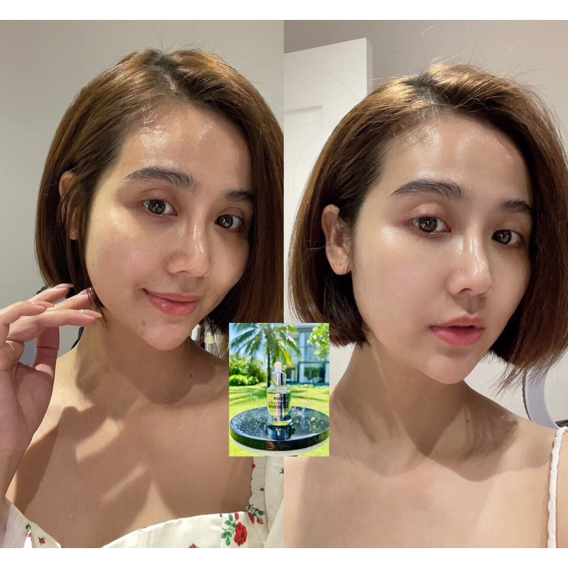 Kem Dưỡng Phục Hồi Tái Tạo Da Sau Peel MOOSE+