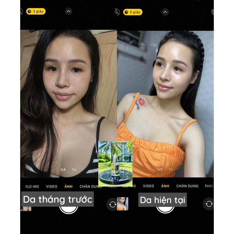 Kem Dưỡng Phục Hồi Tái Tạo Da Sau Peel MOOSE+