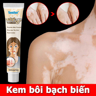 Kem bôi bạch biến kem nám tàn nhang kem làm trắng da thảo mộc cho da nấm ngứa, hắc lào, lang ben, vảy nến, á sừng