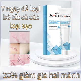 Kem xóa sẹo, loại bỏ hiệu quả các vết sẹo lâu năm,mờ thâm sẹo lồi sẹo lõm sẹo do mụn và giảm rạn da hiệu quả 20g