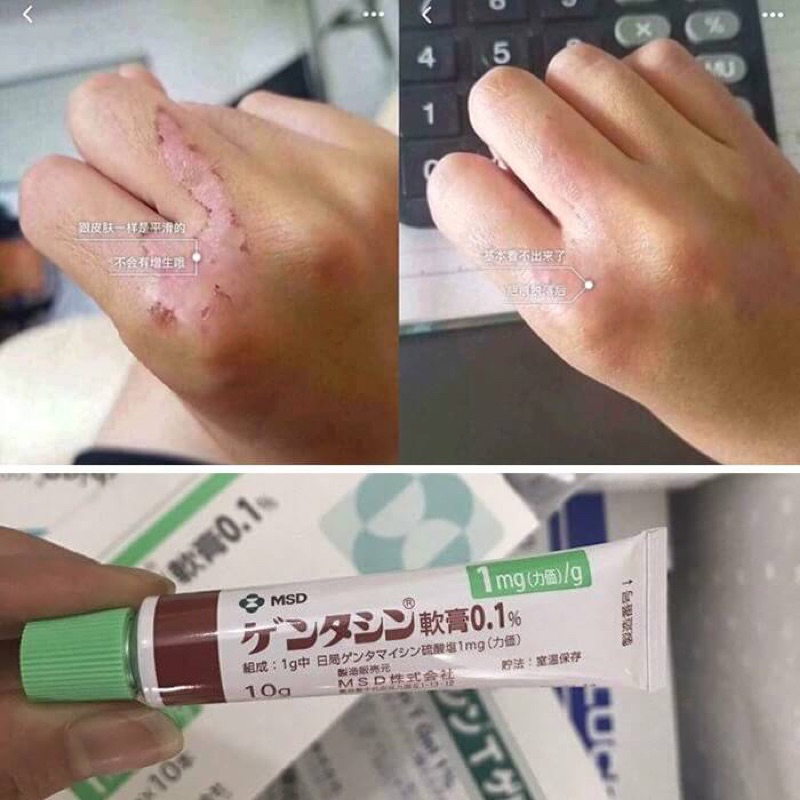 Gel bôi làm mờ vết sẹo, mịn da 10g