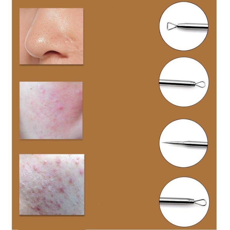 Bộ nhíp nặn mụn 5 món