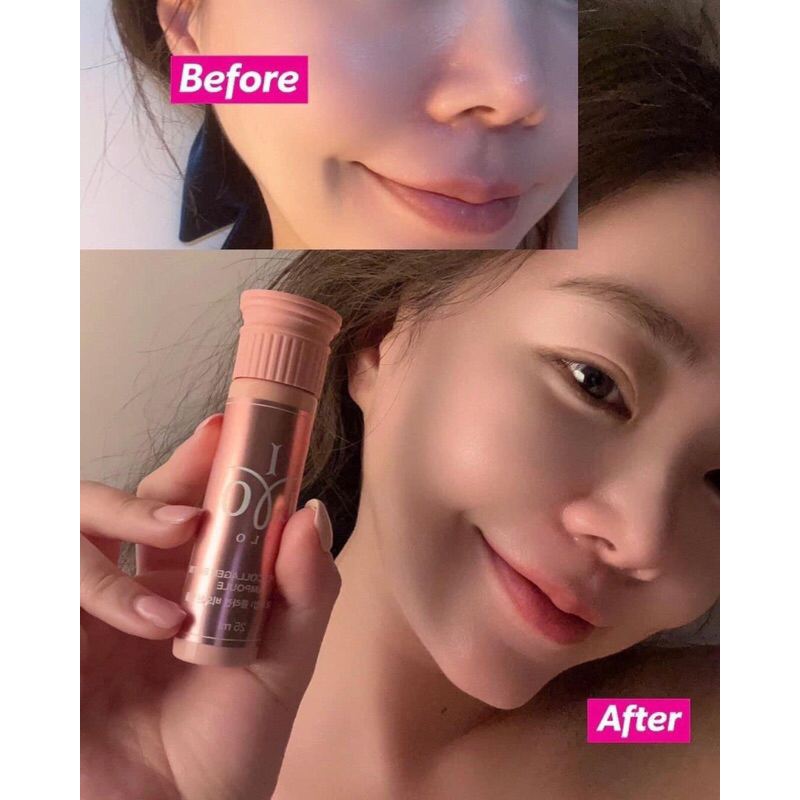 Set Collagen ILO hộp 28 chai