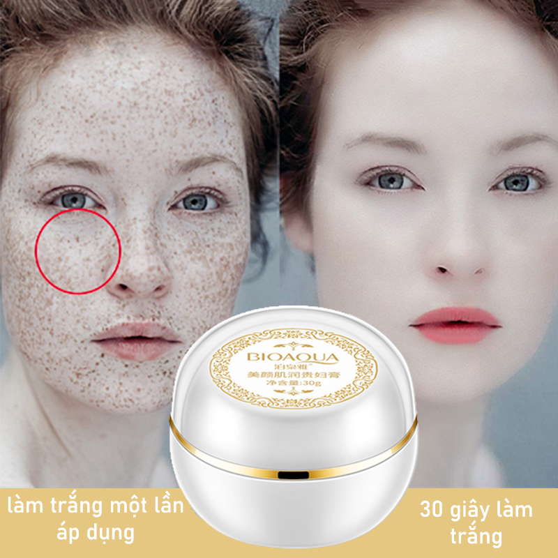 Kem nám tàn nhang kem tàn nhang kem dưỡng trắng da 30g dưỡng trắng Làm sáng tông da tức thì