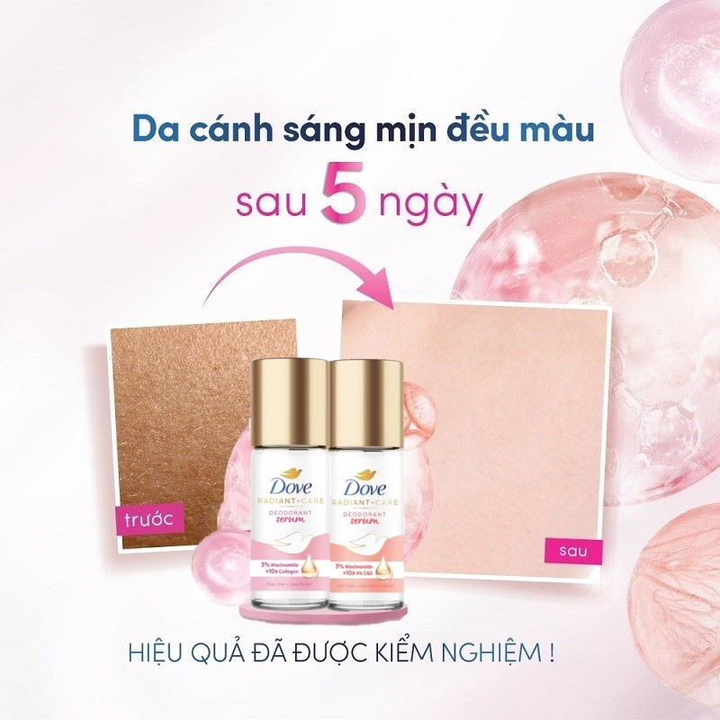 Lăn Khử Mùi Tinh Chất Serum Dưỡng Ẩm, Sáng Da, Mờ Thâm Vùng Da Dưới Cánh Tay Dove NIA .