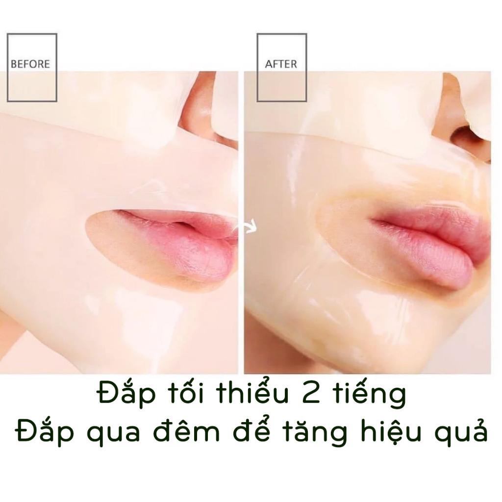 Mặt Nạ Thạch Collagen Medianswer 83% Pure Collagen Tươi Vita Collagen Mask Tái Tạo Chống Lão Hóa Giảm Nếp Nhăn