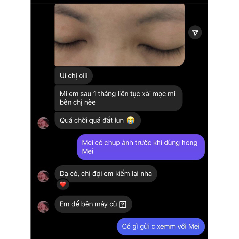 Serum Mọc Mi/Mày có Redensyl giúp hiệu quả rõ