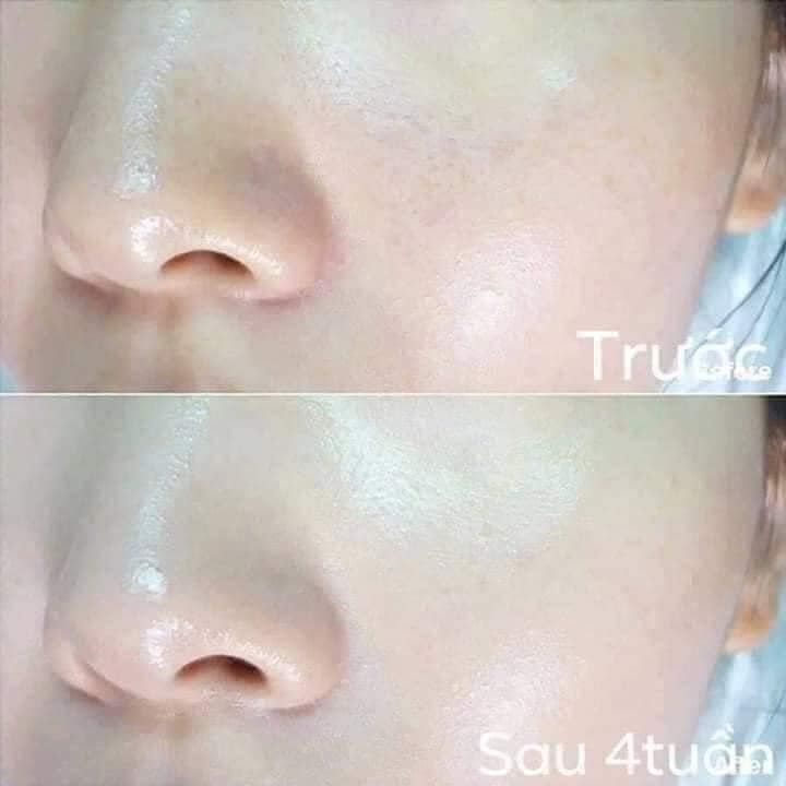 Gói sample Huyết thanh Ohui dưỡng trăng, loại bỏ nám hui The First Geniture Brightening Dual Serum - AB AUTHENTIC