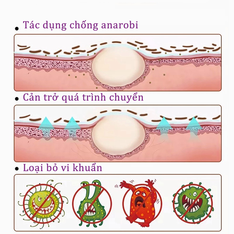 Kem bôi nấm ngứa Kem bôi hắc lào kem bôi ngứa 30g giảm ngứa nhanh chàm viêm da hắc lào ngứa âm đạo gửi hàng bảo mật