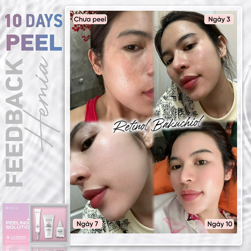 [ Peel Da Căng Bóng Hemia Hàn Quốc]