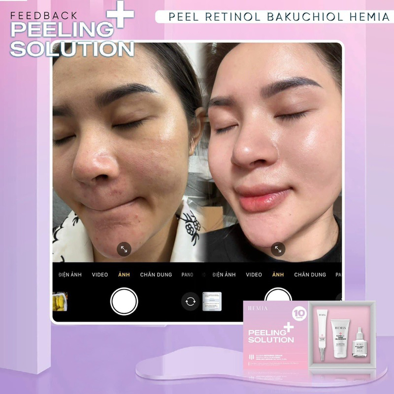 [ Peel Da Căng Bóng Hemia Hàn Quốc]