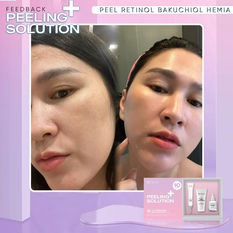 [ Peel Da Căng Bóng Hemia Hàn Quốc]