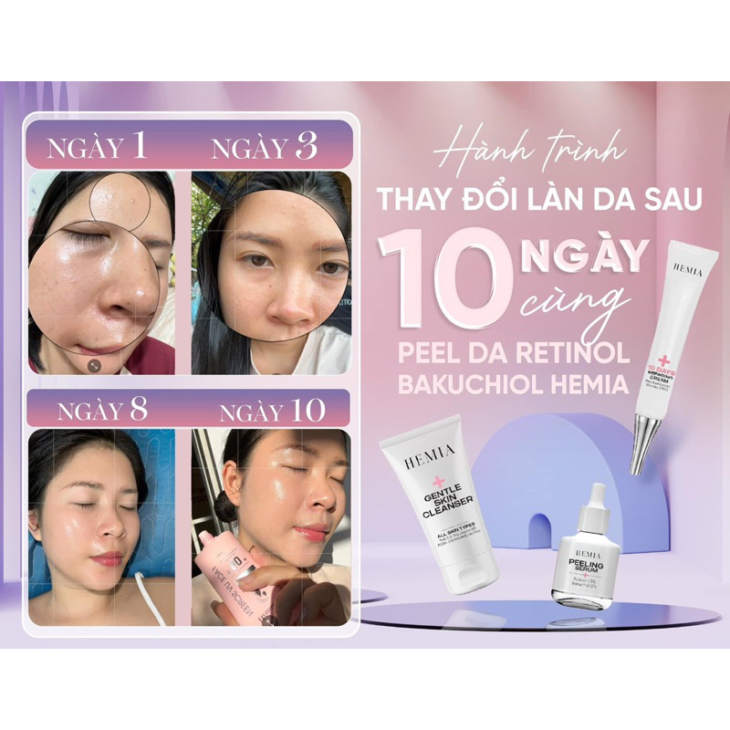 [ Peel Da Căng Bóng Hemia Hàn Quốc]