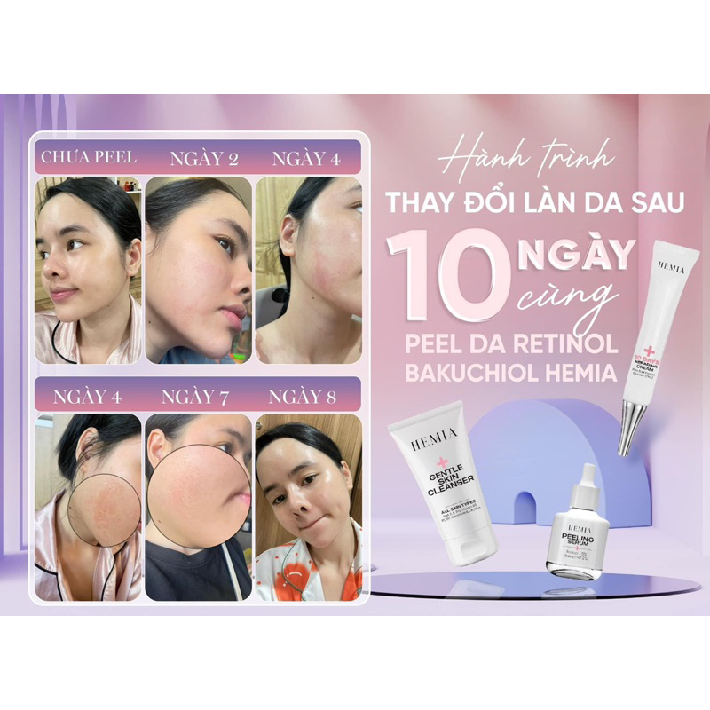 [ Peel Da Căng Bóng Hemia Hàn Quốc]