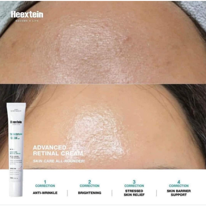 Retinal trắng da, trả hóa 𝐑𝐞𝐭𝐢𝐧𝐚𝐥𝐝𝐞𝐡𝐲𝐝𝐞 𝟏𝟎𝟎,𝟎𝟎𝟎𝐩𝐩𝐦