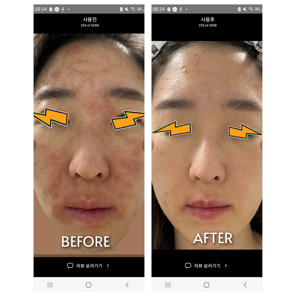 Tinh chất chống lão hoá căng da S.NATURE AQUA COLLAGEN PEPTIDE