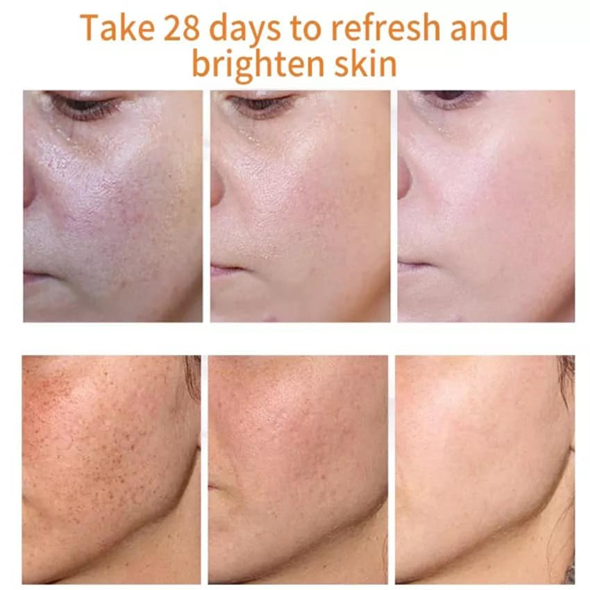 💓ROSANCE X18 GEL TRẮNG DA, XÓA MỜ ĐỐM NÂU, SẸO THÂM - PHÁP 550k sale 80k💓