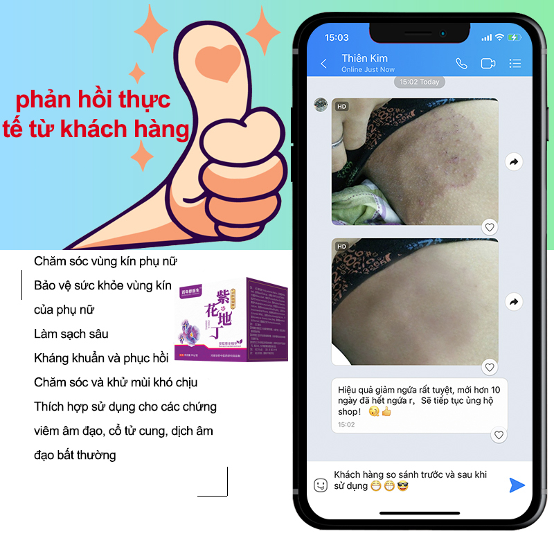 Chăm sóc vùng kín kem Kem giảm ngứa Dùng bên ngoài loại bỏ vùng kín Nấm Ngứa hôi hám kháng khuẩn Làm sạch sâu 30g