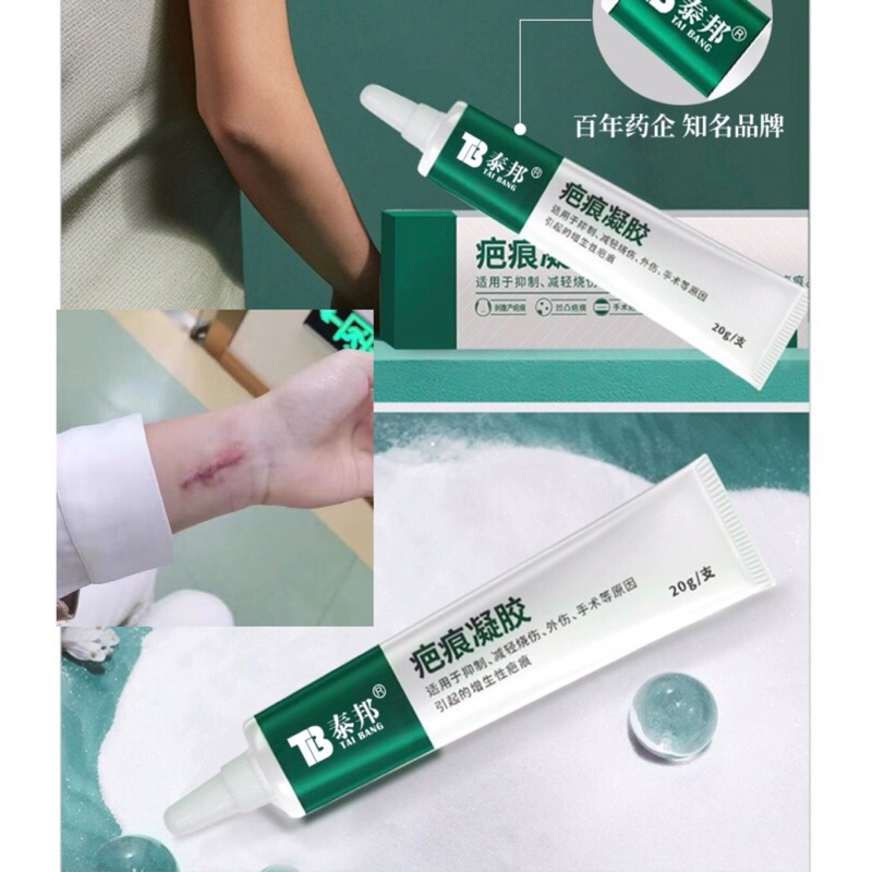 KEM BÔI SẸO VÂN NAM BẠCH DƯỢC