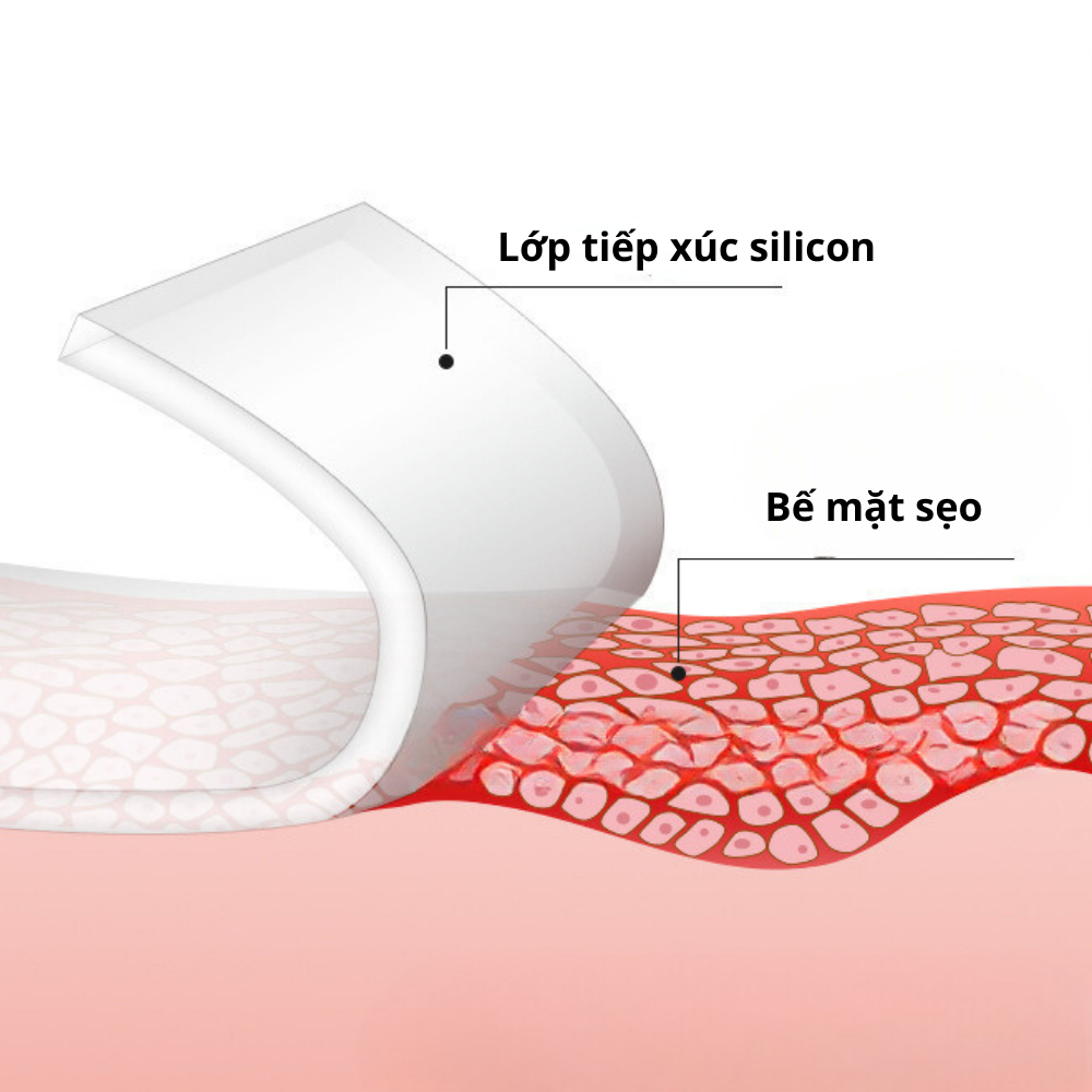 Miếng dán che sẹo che xăm EELHOE silicon cao cấp trùng màu da, miếng dán che sẹo tự dính không thấm nước, bám dính tốt