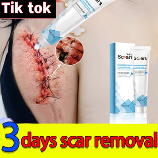 Kem xóa sẹo, kem che sẹo，kem xóa sẹo thâm, lấp đầy sẹo rỗ, sẹo lõm，kem mờ sẹo mờ thâm - kem giảm sẹo và rạn da