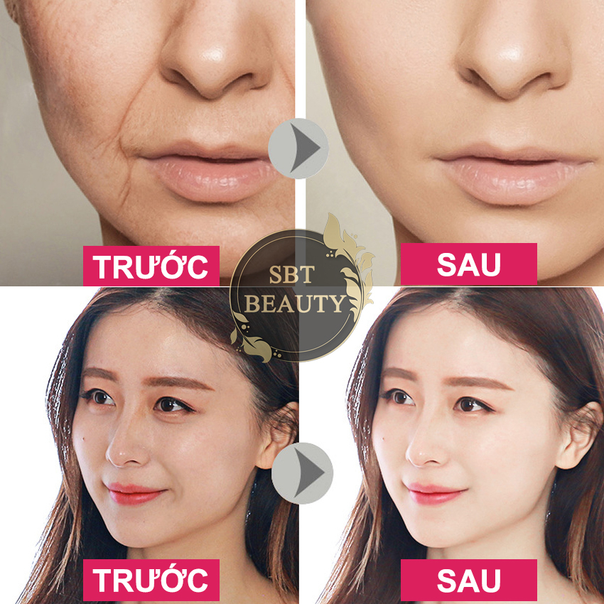 Tinh Chất Vàng Nhân Sâm Dưỡng Ẩm Làm Săn Chắc Da Cấp Nước, Kiểm Soát Dầu, Tẩy Tế Bào Chết Biaoquan 100ml