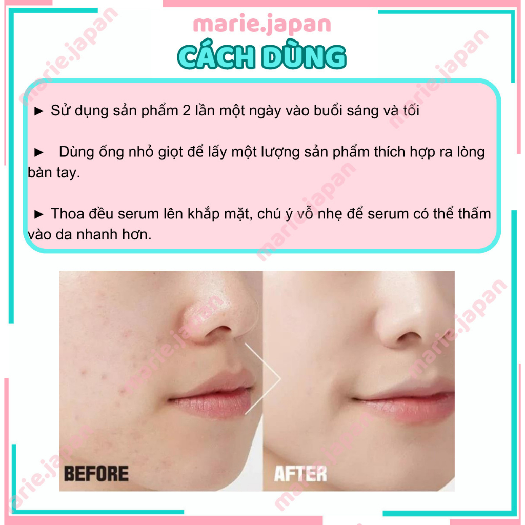 Serum The Ordinary Niacinamide 10% + Zinc 1% giảm mụn mờ thâm 30ml