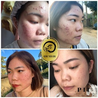 tinh chất Hoàng Thiên Sâm( loại mạnh)
