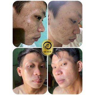 tinh chất Hoàng Thiên Sâm( loại mạnh)